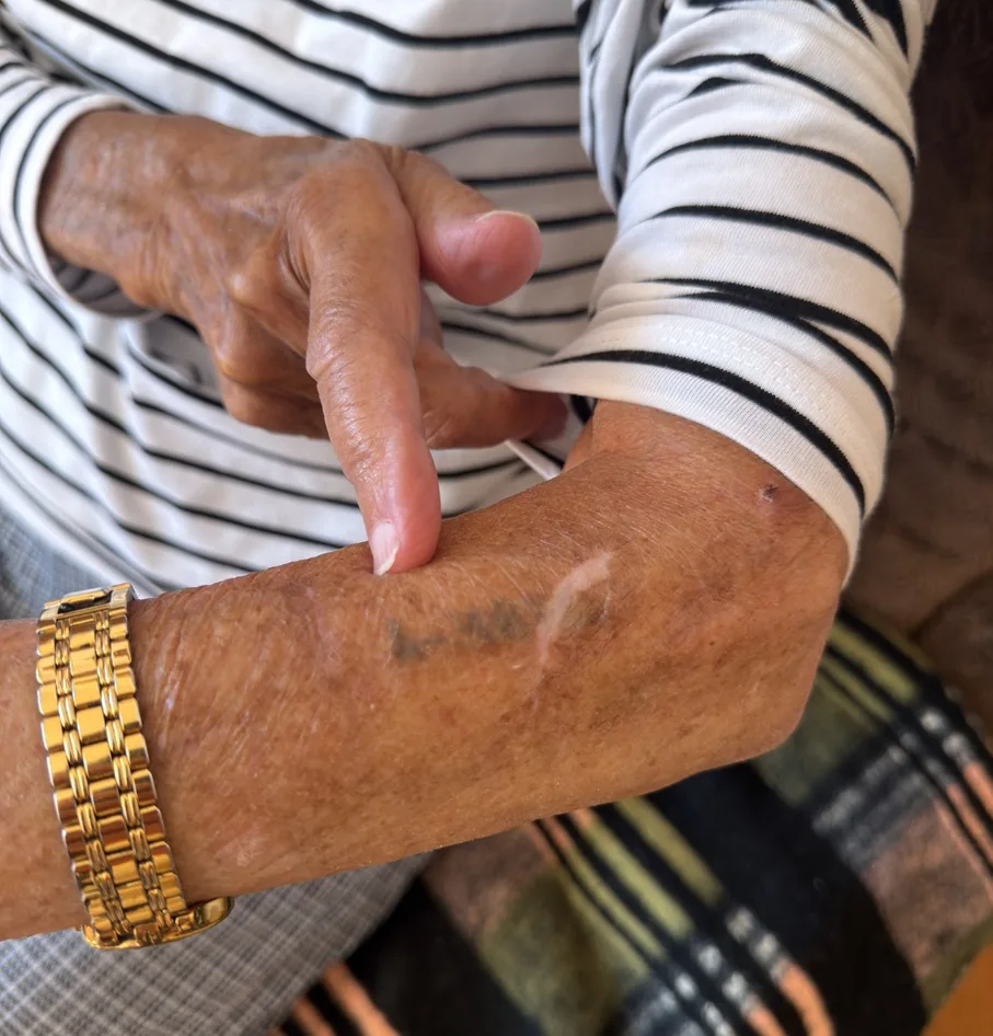 Doris Broulova pointing to the prisoner number tattooed on her arm.