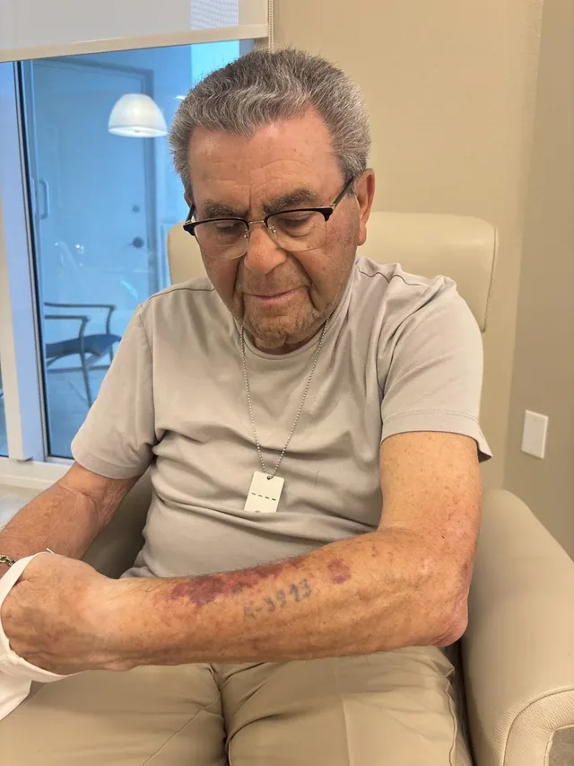 Saul Blau showing his Auschwitz prisoner-number tattoo.